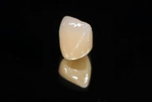 オールセラミッククラウン